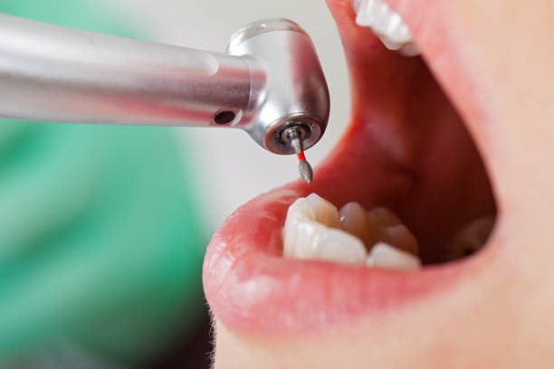 Best Emergency Tooth Extraction in Loch Sheldrake, NY